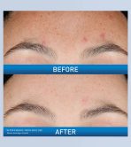Resurfacing Retinol Serum - Image 3