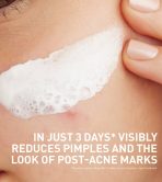 Acne Clay To Foam Cleanser - Image 2