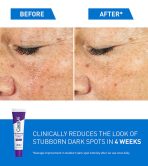 Skin Renewing Brightening Lotion with SPF 30 - Image 5